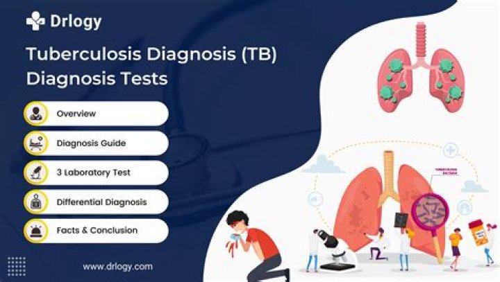 How can bovine tuberculosis be diagnosed?