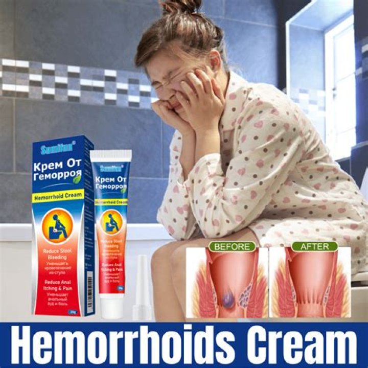 What cream shrinks hemorrhoids fast?
